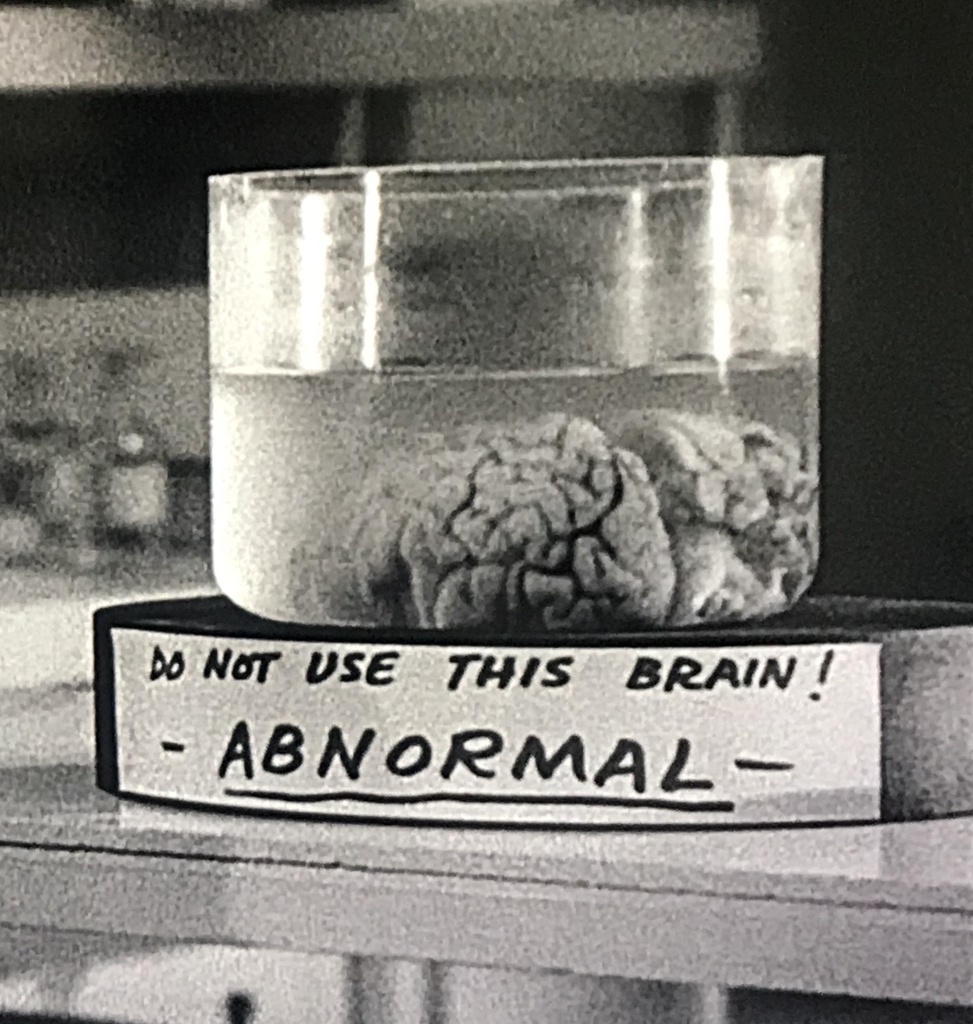 Abby Normal